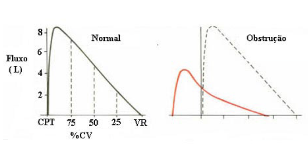 Curvas espirometria DVO